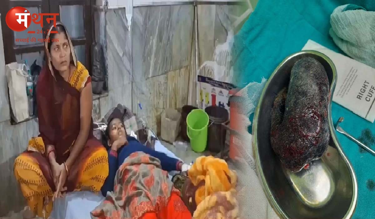 मुजफ्फरपुर की 9 वर्ष की बच्ची के पेट से निकले डेढ़ किलो बाल, ट्राइकोटिलोमेनिया नामक मनोरोग से ग्रस्त बच्ची का डॉक्टरों ने किया सफल ऑपरेशन।