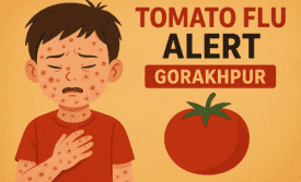 Tomato Flu